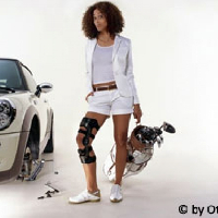 Ortézisek, protézisek, térdrögzítő, műláb, járógép, fűző, korzett, lúdtalpbetét készítés